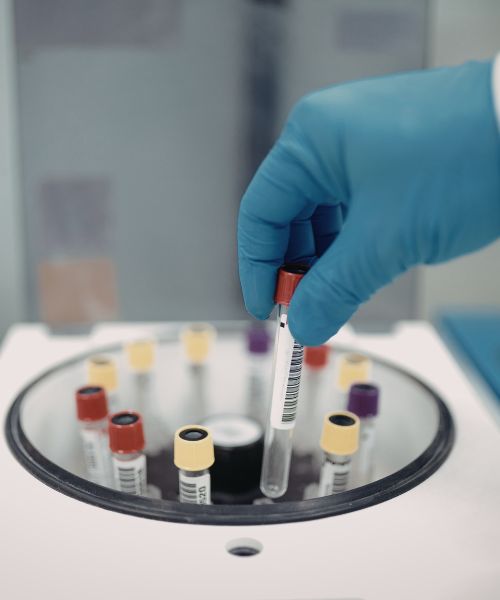NPL Diagnostics Lab Technician